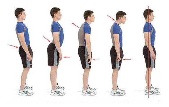 Prevención de la osteocondrosis