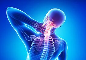 Signos de osteocondrosis cervical