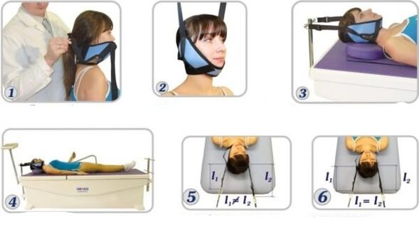 tratamiento de la osteocondrosis cervical mediante tracción