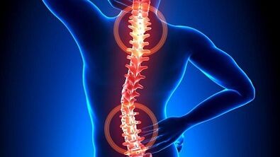 mecanismo de desarrollo de la osteocondrosis