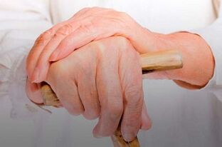 dolor en las articulaciones de los dedos con artritis reumatoide