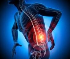 varias causas de dolor de espalda