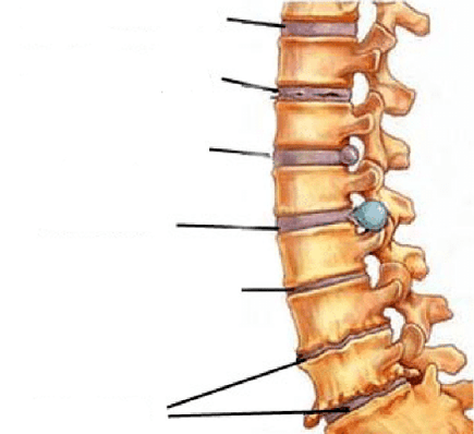 etapas de desarrollo de la osteocondrosis de la columna vertebral