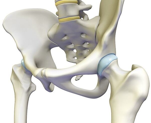 La osteocondrosis provoca un dolor agudo en la articulación de la cadera. 